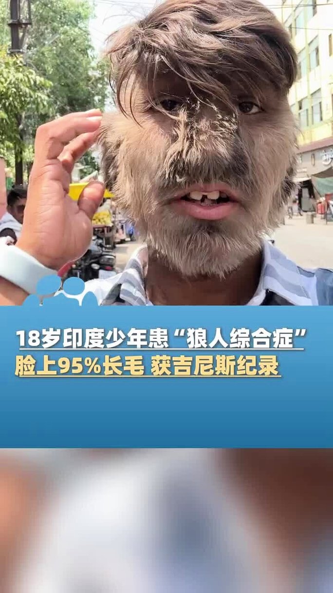 一边叫床一边摸一边爽的相关介绍